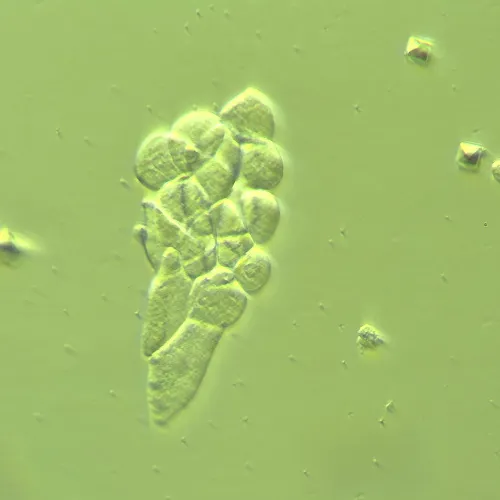 zdjęcie Urządzenie do pracy z kontrastem modulacyjnym Hoffmana MAGUS HCM360, z zestawem obiektywów,  14