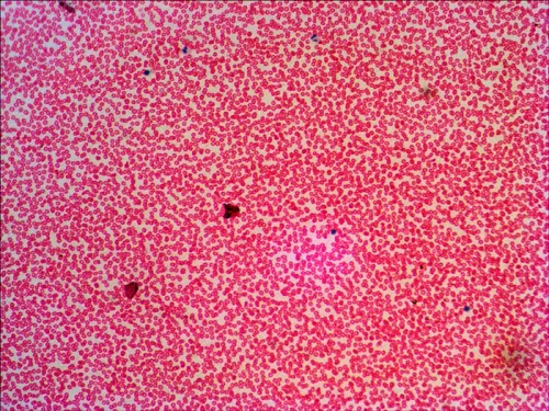 fotografia Zestaw gotowych preparatów Levenhuk N38 NG,  16