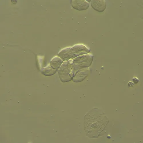 zdjęcie Urządzenie do pracy z kontrastem modulacyjnym Hoffmana MAGUS HCM360, z zestawem obiektywów,  13